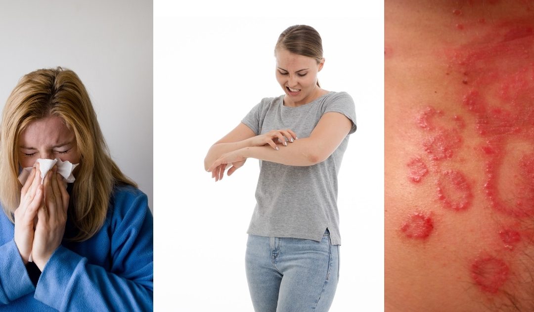 ALLERGOLOGA 10 GIUGNO ULTIMI POSTI