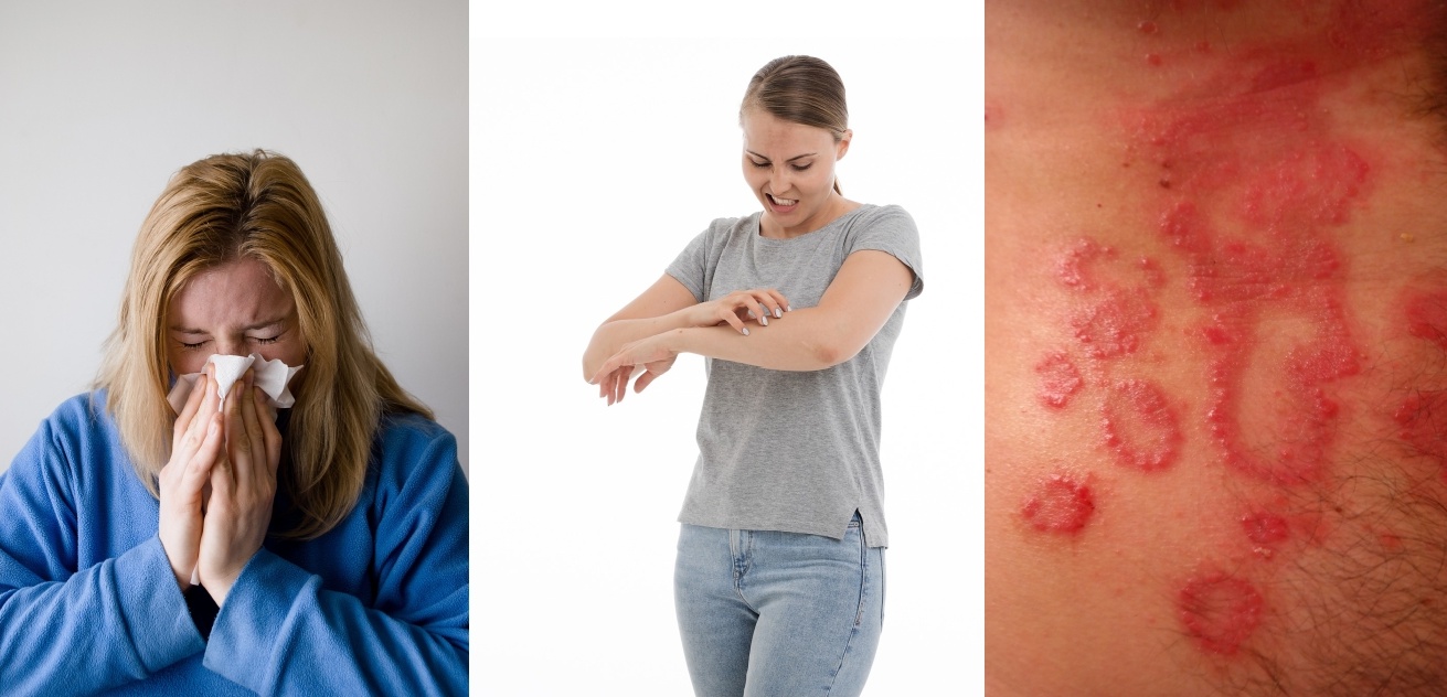 ALLERGOLOGA 10 GIUGNO ULTIMI POSTI ALLERGOLOGA 10 GIUGNO ULTIMI POSTI